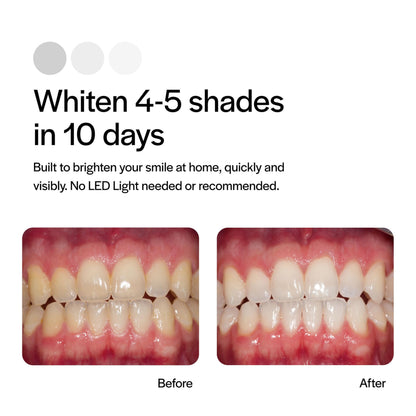 Opalescence GO 15 Whitening Bundle | 7 Treatments | Prefilled Trays + Travel Sensitive Toothpaste Mint