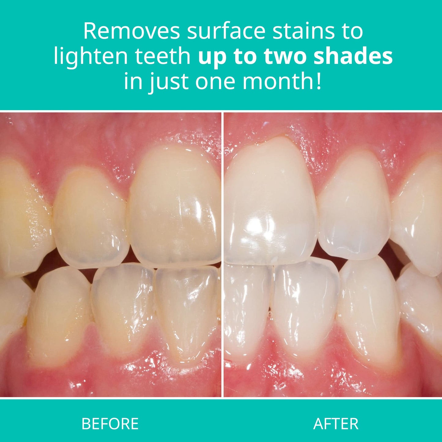 Opalescence Whitening Toothpaste for Sensitive Teeth (2 Pack) - Mint, Gluten Free | TP-5167-2