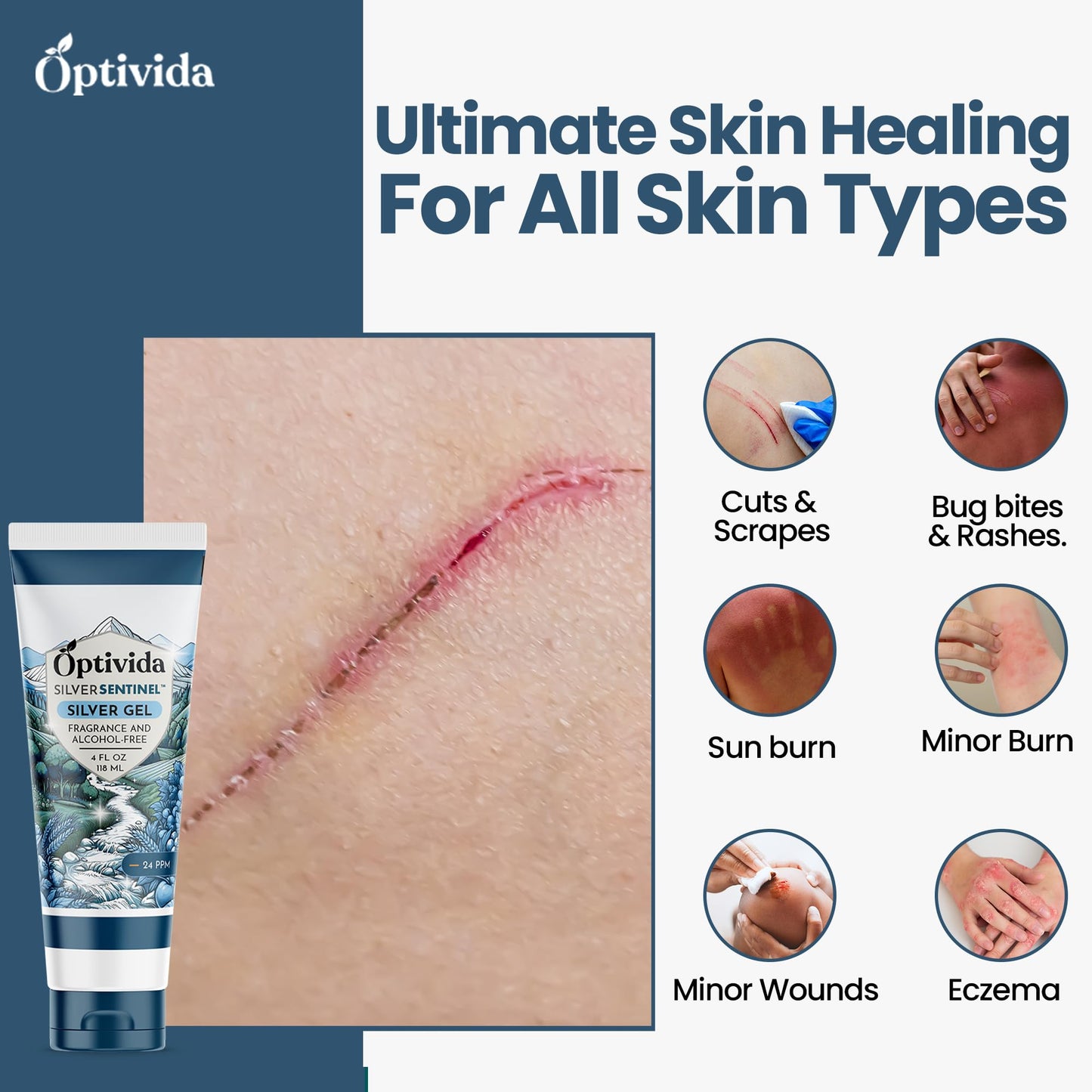 OPTIVIDA Colloidal Silver Gel for Wound Care – Unscented Nano-Silver Topical Gel (4 oz)