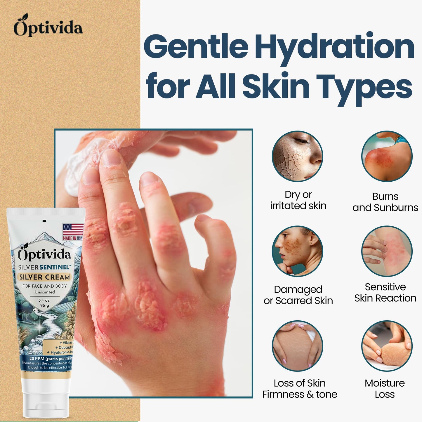Optivida Nano Silver Skin Healing Cream – Hydrating Ointment for Burns, Wounds, Scars & Acne
