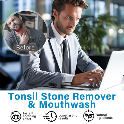 Tonsil Stone Mouthwash - Removes Stones, Relieves Bad Breath & Dry Mouth