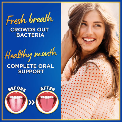 Oral Probiotics for Teeth & Gums – 3bn CFU Dental Probiotic Tablets
