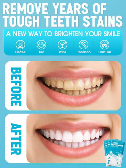 Oralfree Natural Teeth Whitening Strips for Sensitive Teeth | Enamel-Safe, Mint, 28 Strips