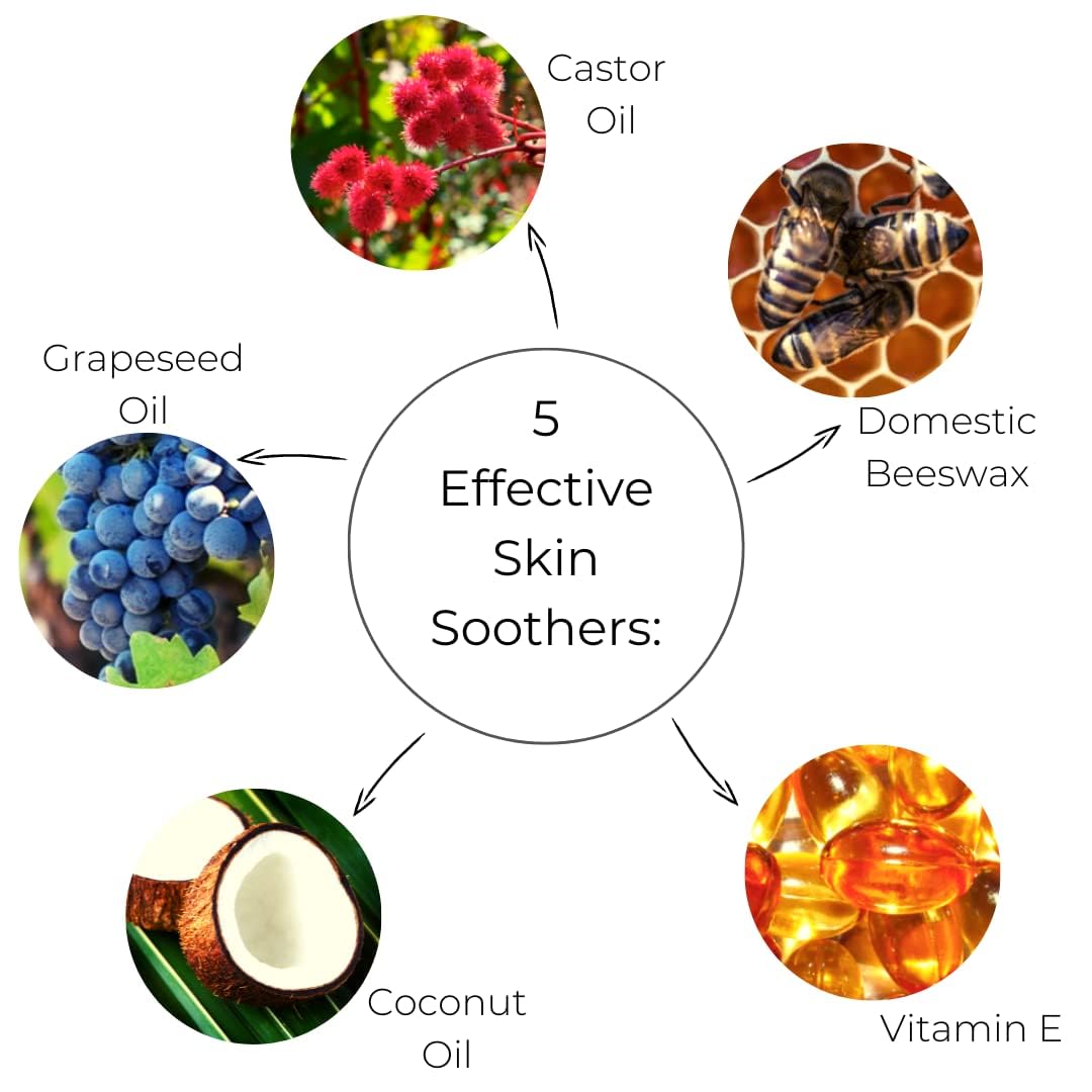 Ora's Amazing Herbal Touchy Skin Salve – Sensitive Skin Eczema Cream (4 oz)