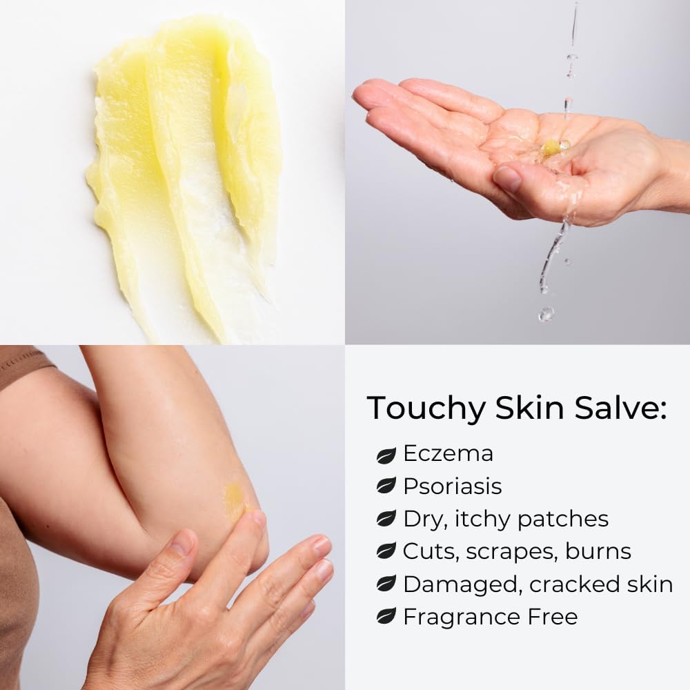 Ora's Amazing Herbal Touchy Skin Salve – Sensitive Skin Eczema Cream (4 oz)