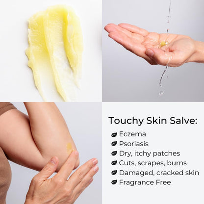 Ora's Amazing Herbal Touchy Skin Salve – Sensitive Skin Eczema Cream (4 oz)