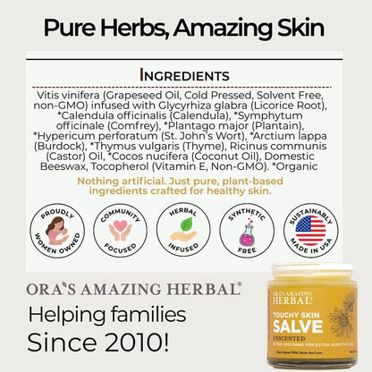 Ora's Amazing Herbal Touchy Skin Salve – Sensitive Skin Eczema Cream (4 oz)