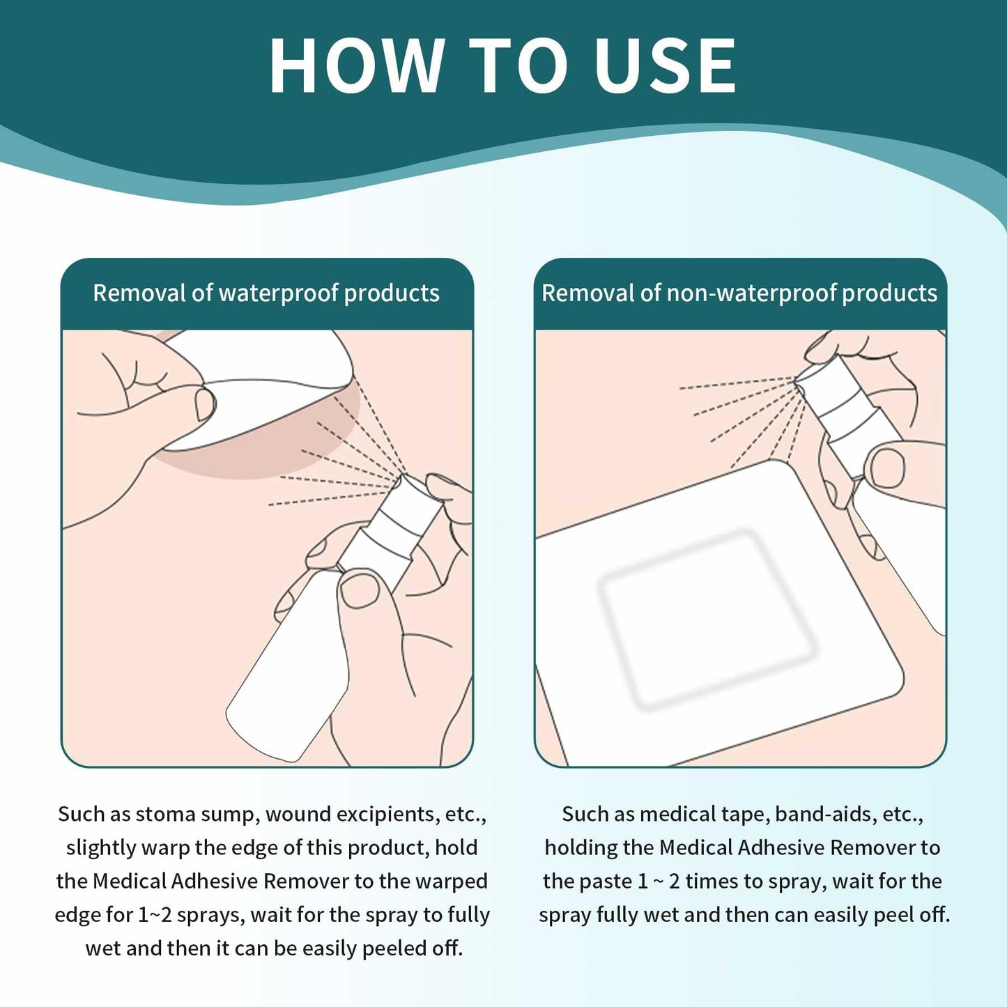 ovand Medical Adhesive Remover Spray - 1 oz | Gentle, Skin-Safe Ostomy Adhesive & Tape Removal