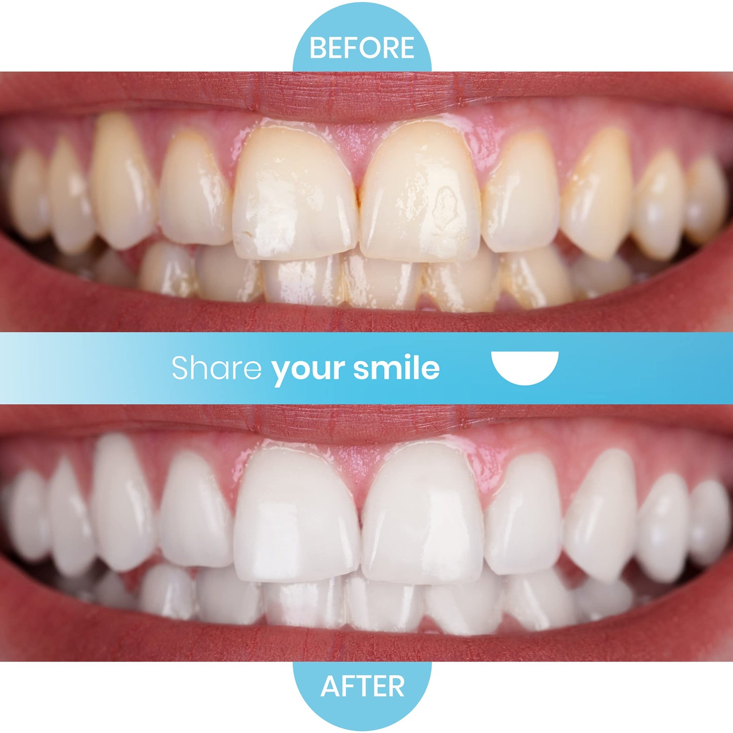 Purean Teeth Whitening Oxystrips – 40 Pure Atomic Oxygen Releasing White Strips – 20 Treatments