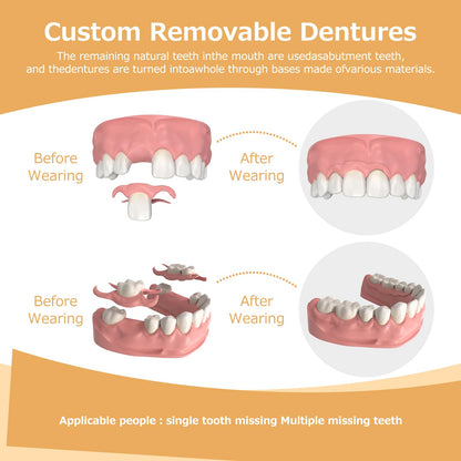 Partial Dentures - Lightweight, Unbreakable Replacement Teeth (5 Teeth) for Missing Teeth | Men & Women