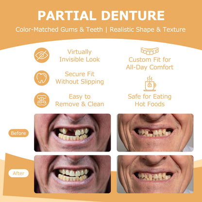 Partial Dentures for Missing Teeth & Gaps — Lightweight, Unbreakable Replacement Teeth (1 Tooth)
