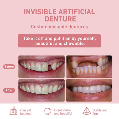 Custom Partial Dentures – Personalized Removable Denture Set for Missing Teeth | 1–6 Tooth Replacement with Storage Case | Natural Look & Comfortable Fit (5 Teeth)