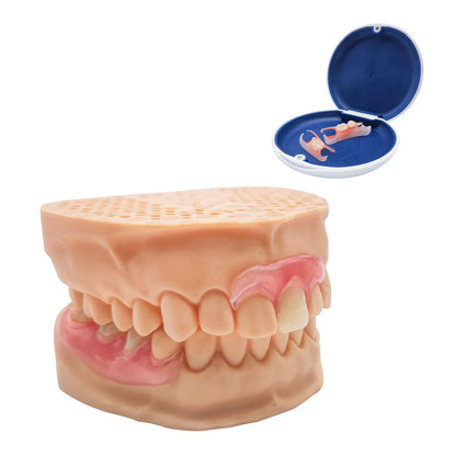 Custom Partial Dentures – Personalized Removable Denture Set for Missing Teeth | 1–6 Tooth Replacement with Storage Case | Natural Look & Comfortable Fit (5 Teeth)