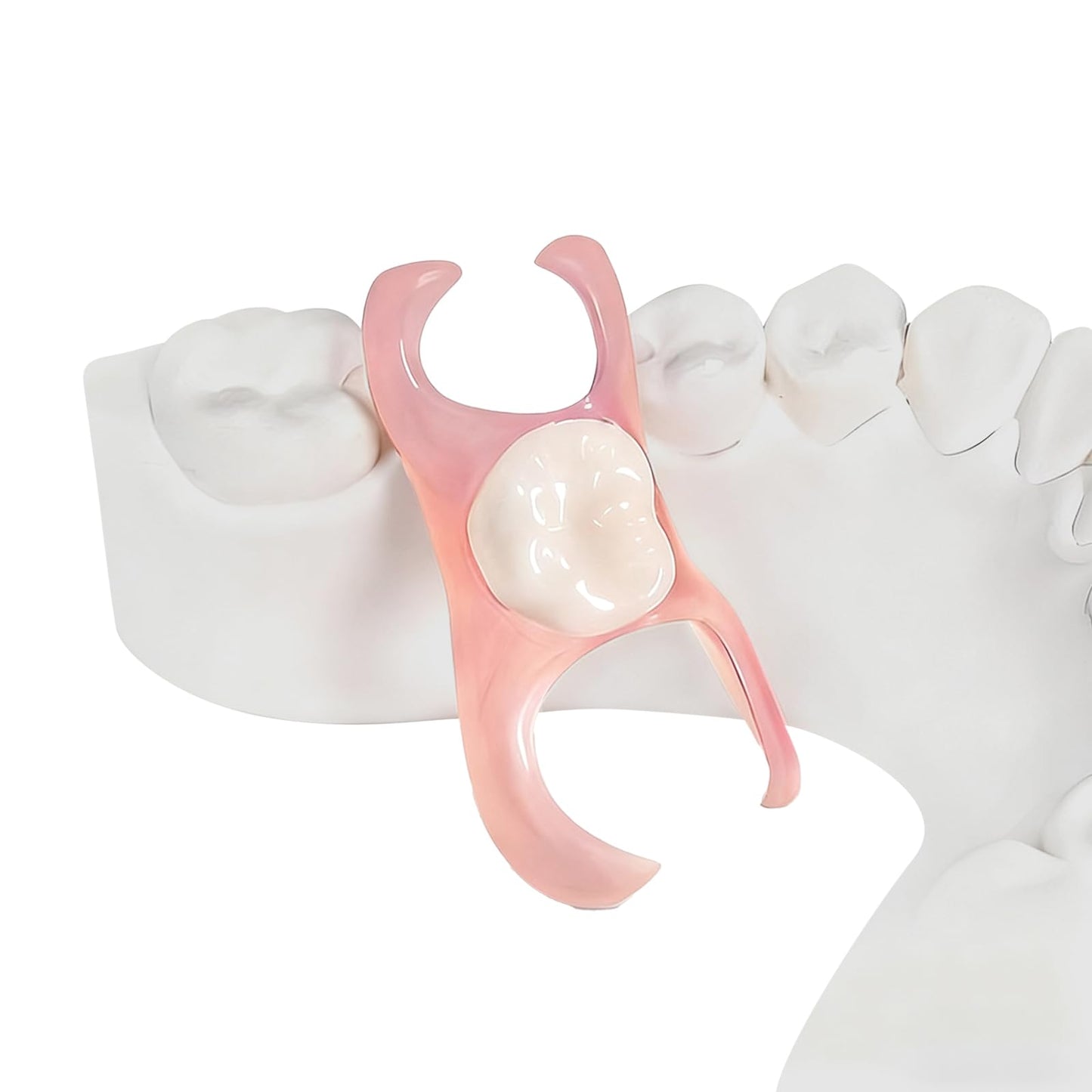 Partial Dentures - Custom Removable Tooth Replacement for Missing Teeth (1 Tooth)