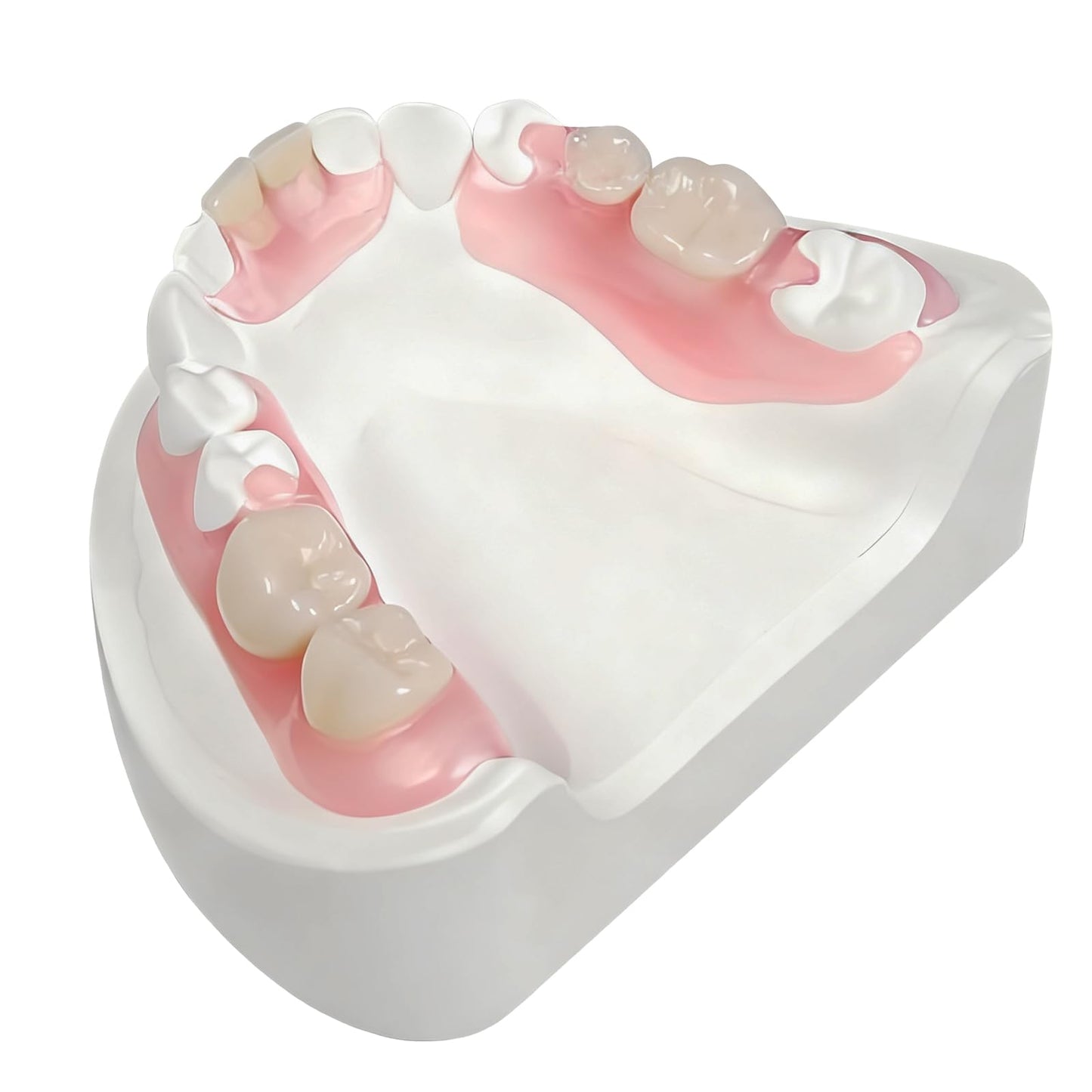 Partial Dentures - Custom Removable Tooth Replacement for Missing Teeth (1 Tooth)