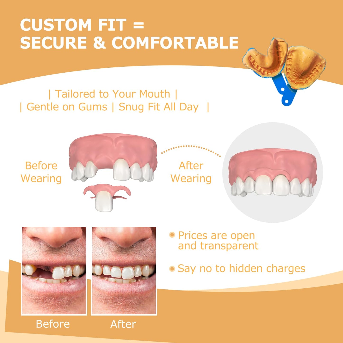 Partial Dentures for Missing Teeth & Gaps — Lightweight, Unbreakable Replacement Teeth (1 Tooth)