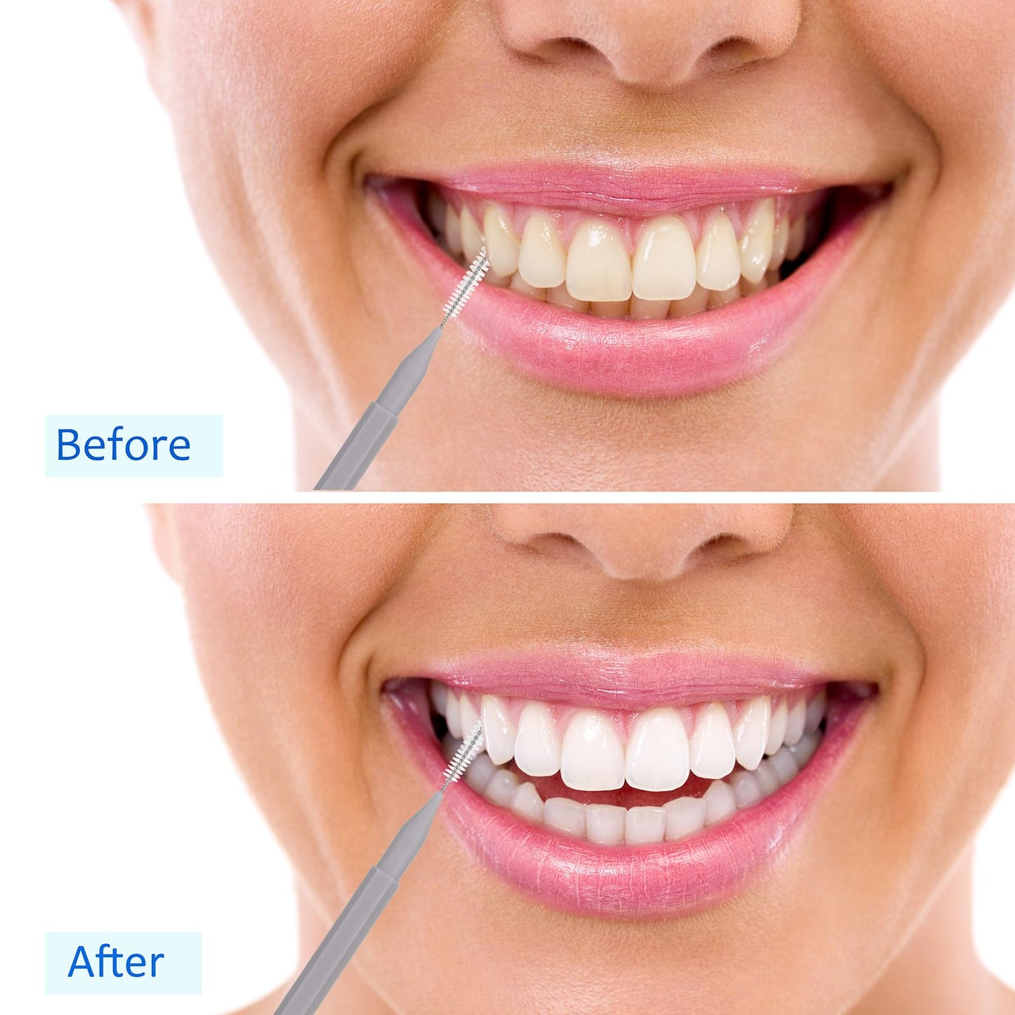 Patelai 100Pcs Braces Brush – Interdental Toothpick & Flosser Set