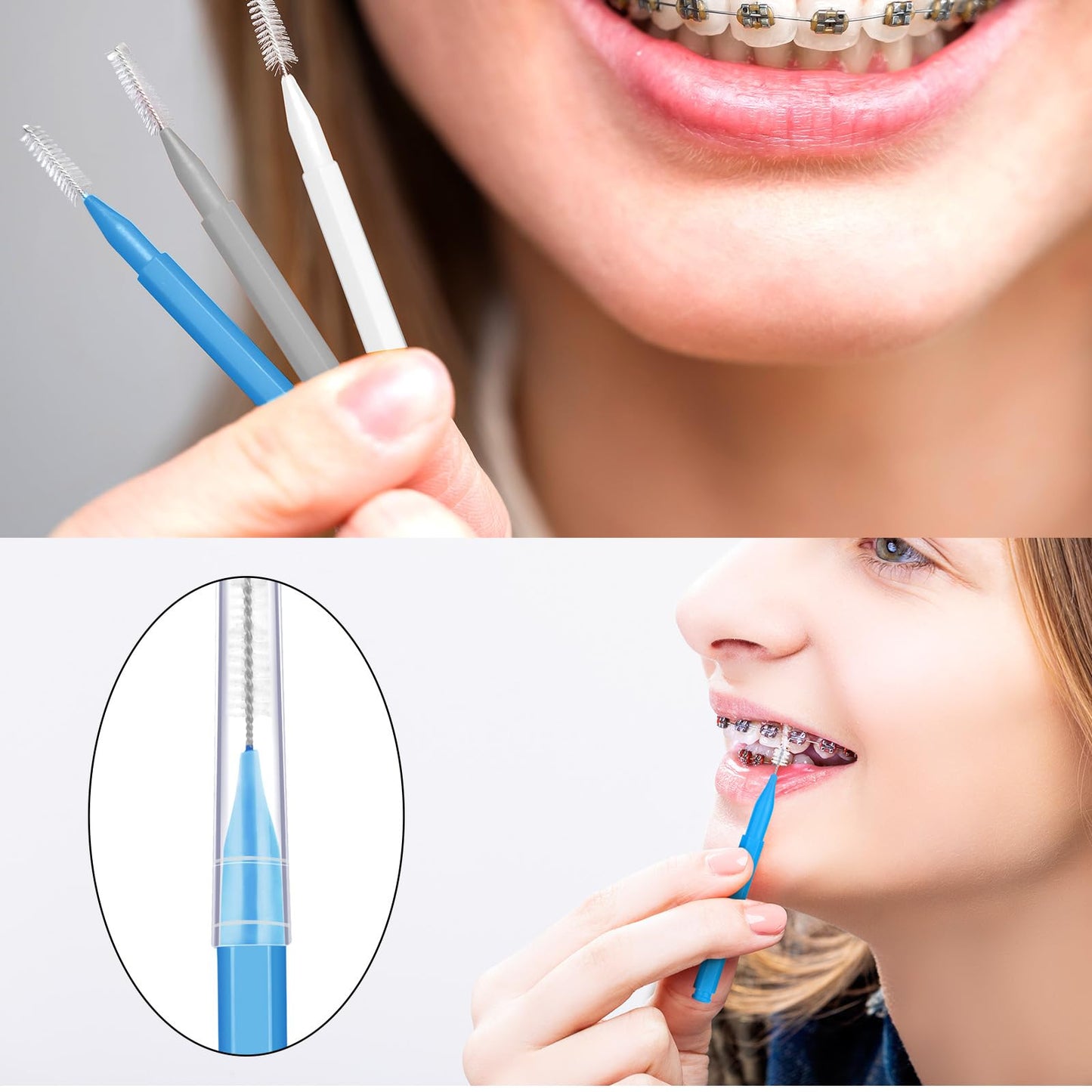 Patelai 100Pcs Braces Brush – Interdental Toothpick & Flosser Set