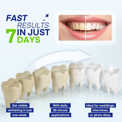 Pearl Smile Teeth Whitening Pen – 5-Pack, 35% Carbamide Peroxide Gel