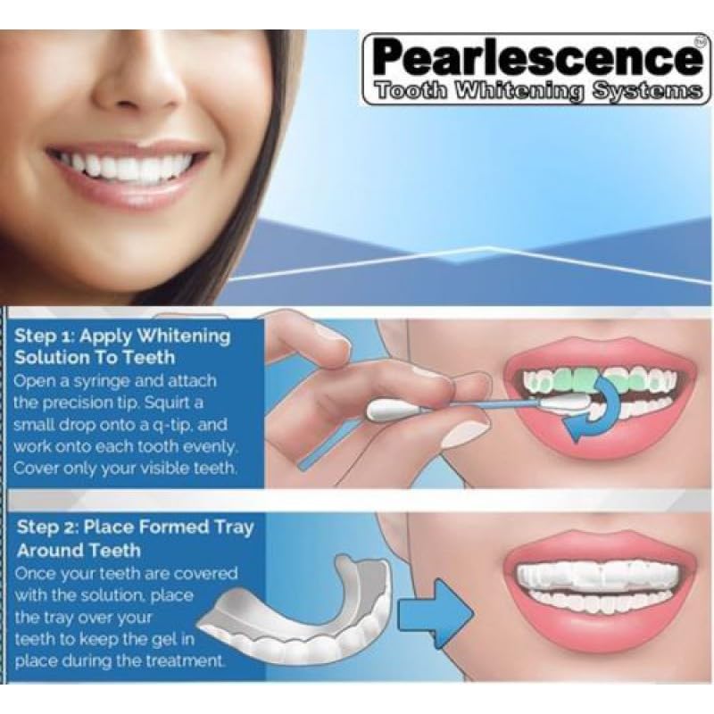 Pearlescence Teeth Whitening System 16% Carbamide Peroxide Gel Kit – 2x10ml Mint Gel, 3 Boil and Bite Trays, Shade Guide