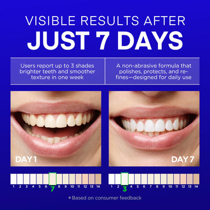 PearlSmile Hydroxyapatite Niacinamide Whitening Toothpaste – 10% nHAp + 5% Niacinamide – Fluoride-Free, 4.2oz (3-Pack)