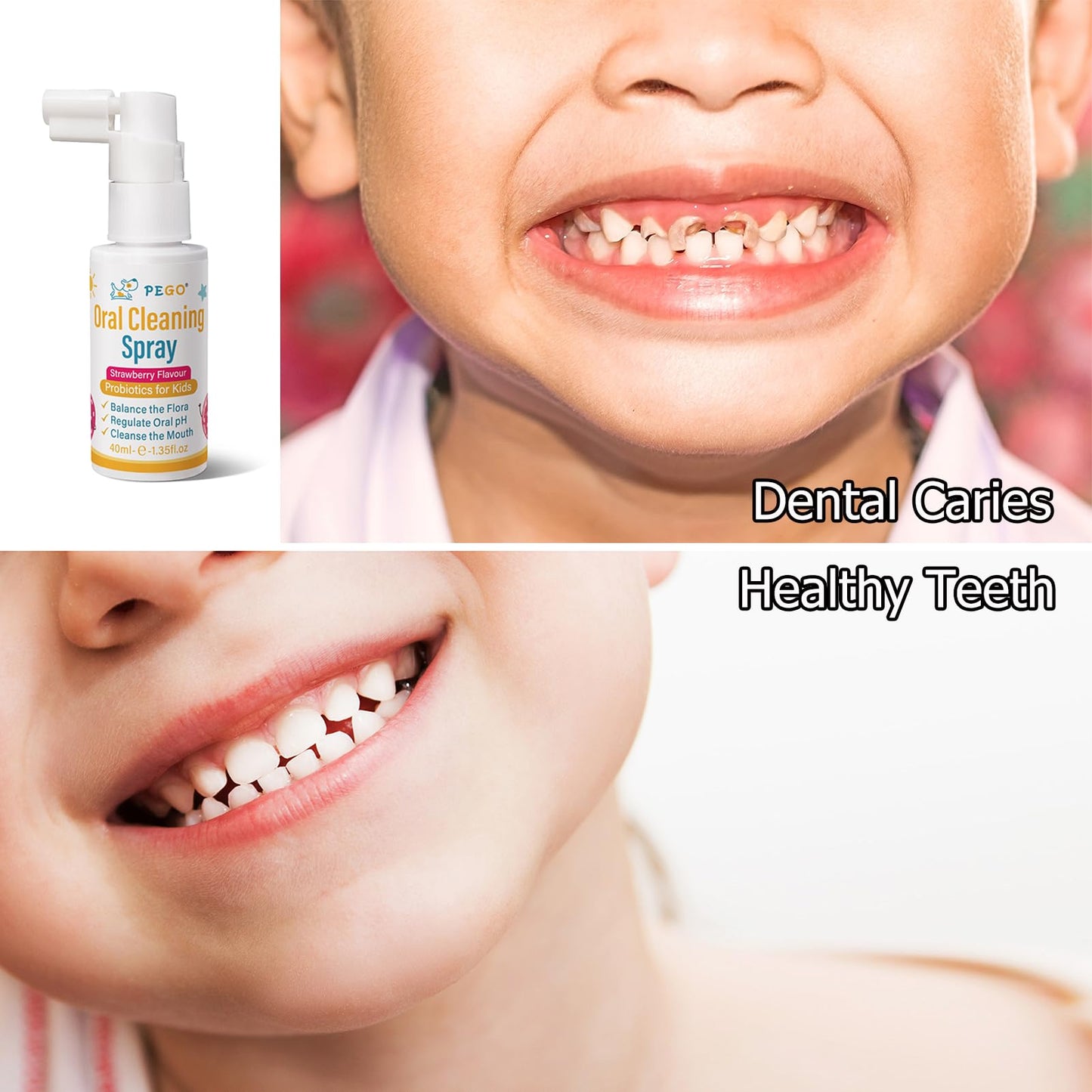 PEGO Kids Oral Spray - Cavity Prevention & Fresh Breath for Newborn to Preschoolers (40ml)