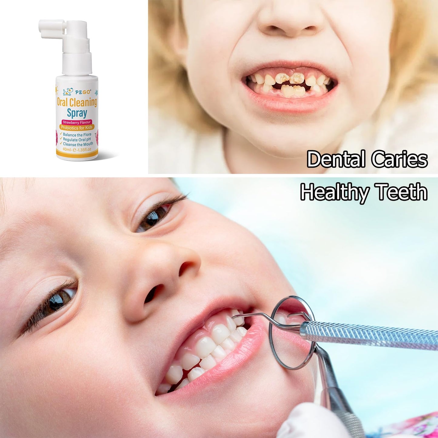PEGO Kids Oral Spray - Cavity Prevention & Fresh Breath for Newborn to Preschoolers (40ml)