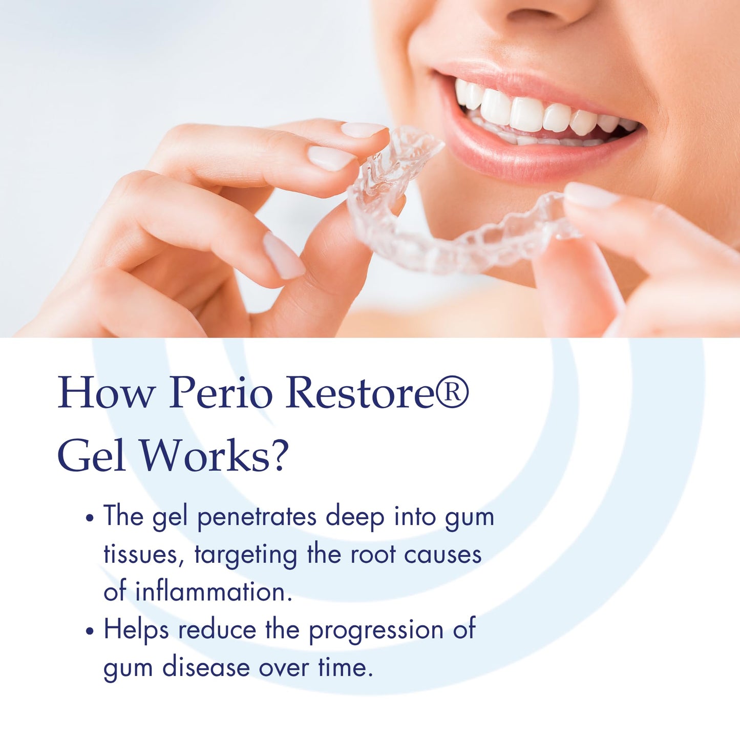 Perio Restore Gel 3 oz – 1.7% Hydrogen Peroxide Oral Cleansing Gel, Mint