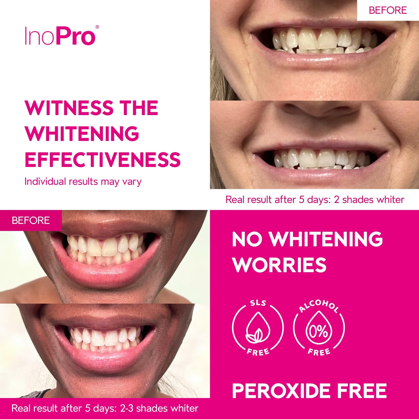 InoPro Teeth Whitening Strips Kit – 42 Strips, 21 Treatments, Peroxide Free