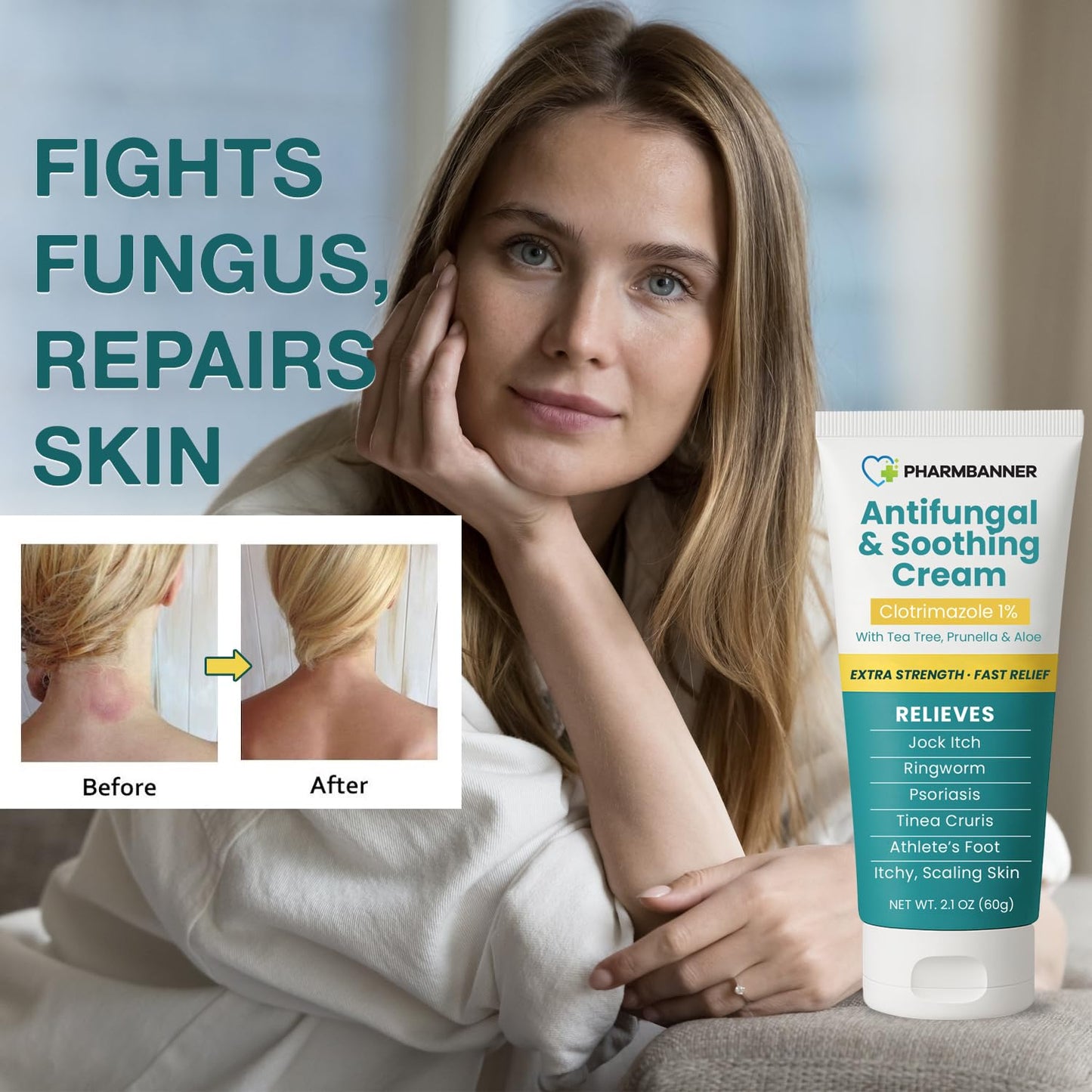 PHARMBANNER Antifungal Cream – Extra Strength Relief for Jock Itch, Athlete’s Foot, Ringworm & Psoriasis