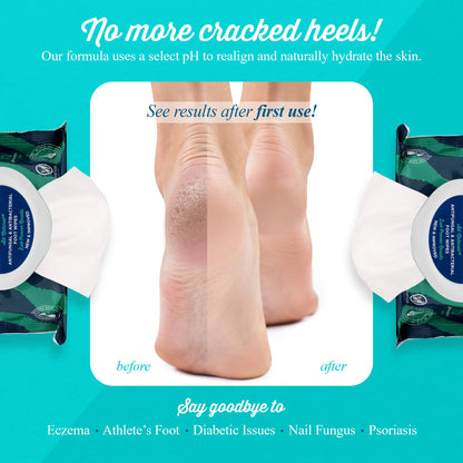 pHeet Foot Wipes – All-Natural Antifungal & Antibacterial Foot Care (72 Count)
