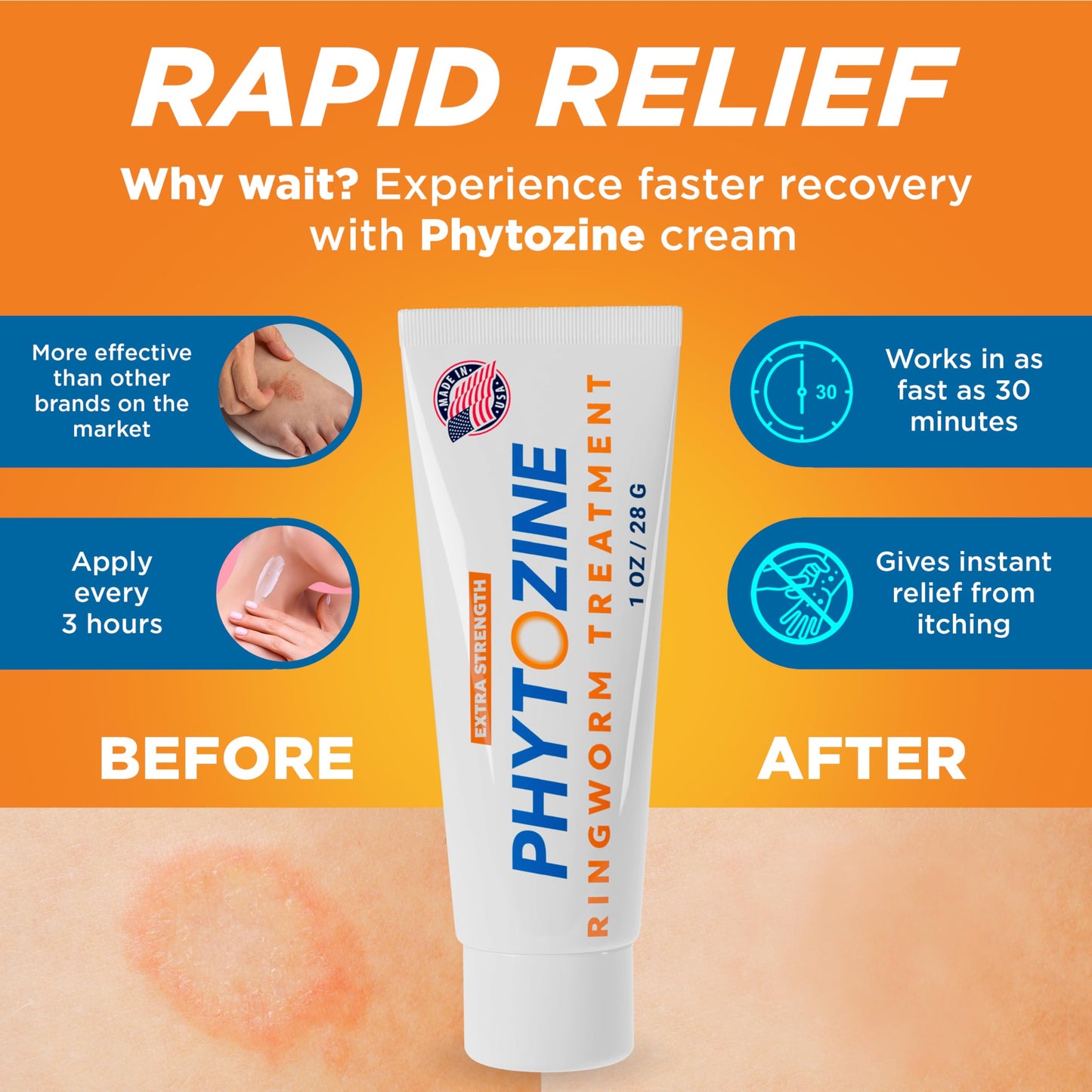 PHYTOZINE Anti Fungal Cream 1% Tolnaftate – Ringworm & Athlete’s Foot Treatment (USA) | 1 oz