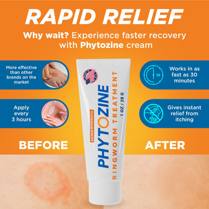 PHYTOZINE Anti Fungal Cream 1% Tolnaftate – Ringworm & Athlete’s Foot Treatment (USA) | 1 oz