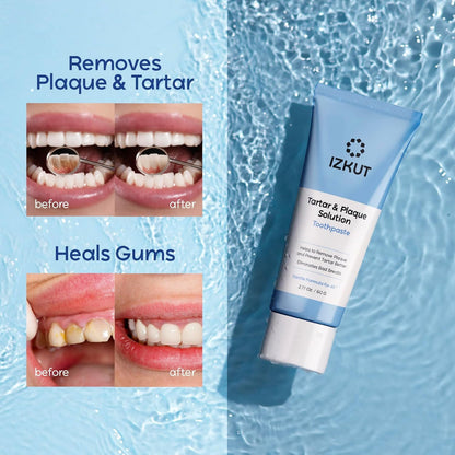 Plaque & Tartar Remover Toothpaste - Deep Clean & Mint Fresh Breath