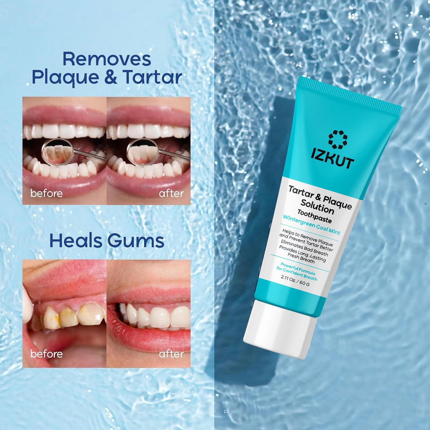 Plaque & Tartar Remover Toothpaste – Deep Clean, Tartar Control (Wintergreen)