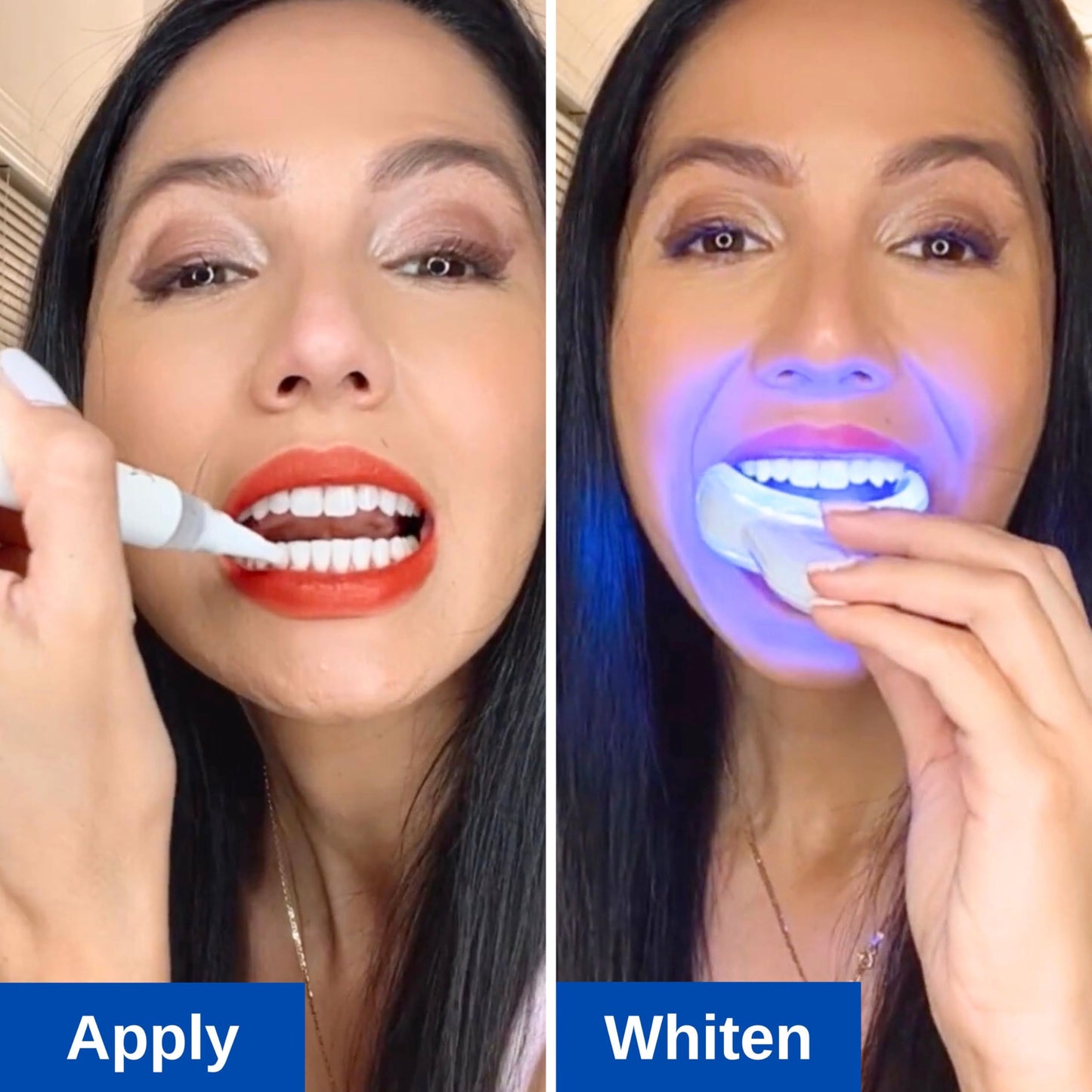 Polar MD Teeth Whitening Kit – 1 Year Supply, 60 Treatments, Gel Pens, 32 LED Light