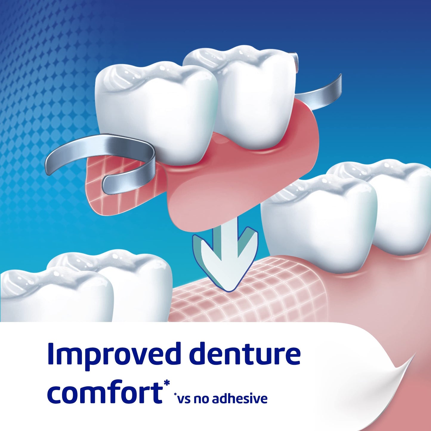 Poligrip Ultra Denture Fixative Cream 40 g – All-Day Hold