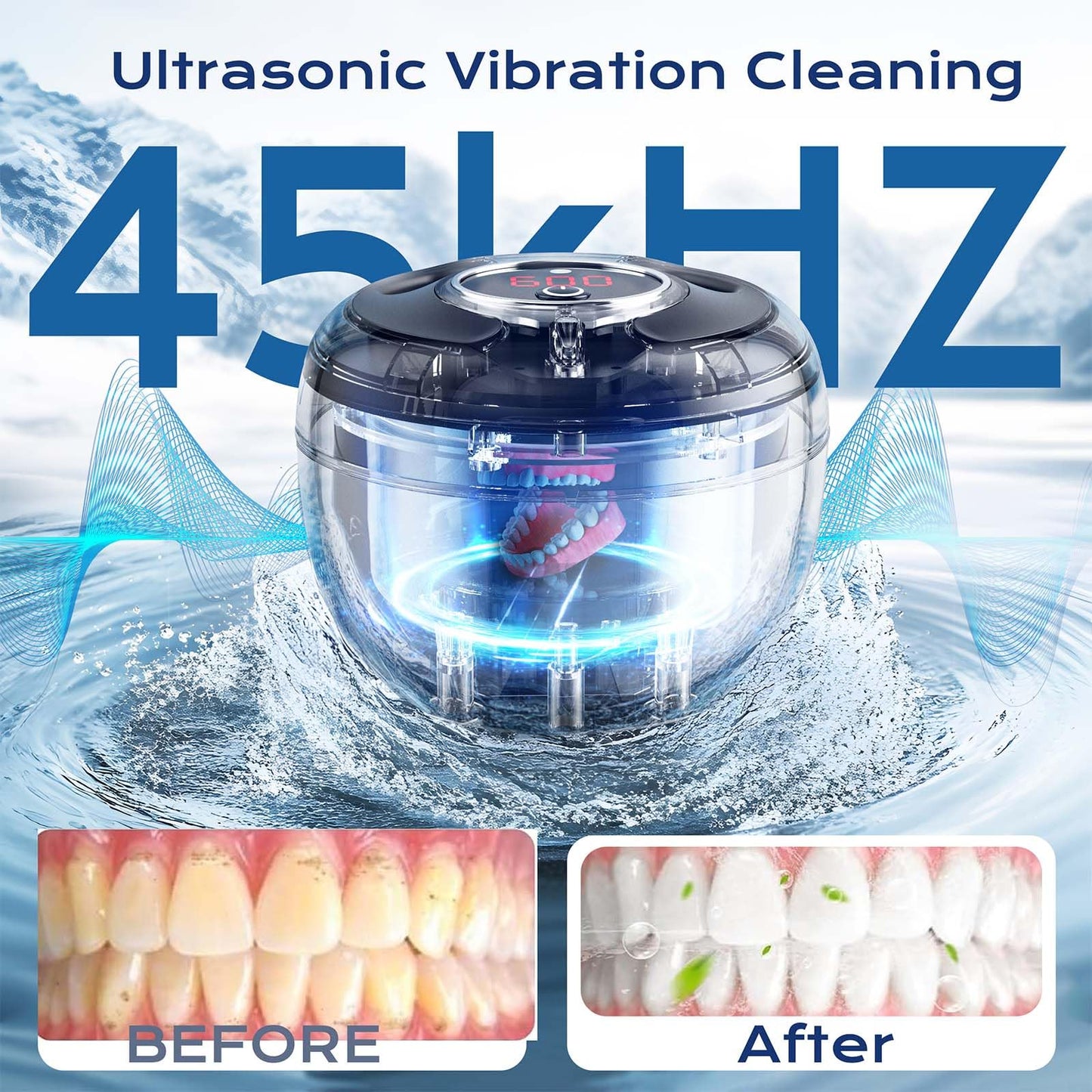Ultrasonic Retainer Cleaner 2025 Upgraded – 45kHz 200ml for Dentures, Braces & Jewelry