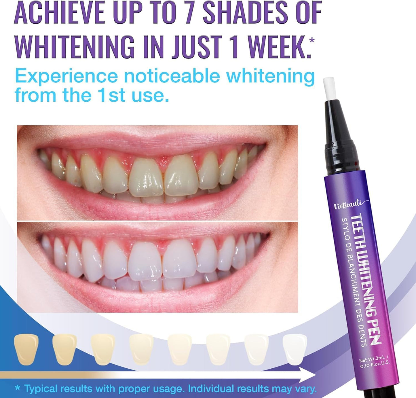 Viebeauti Teeth Whitening Pen Gel – Carbamide Peroxide for Sensitive Teeth (0.2 fl oz)