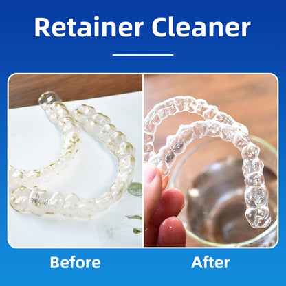 PROJECT BETTER Retainer Cleaner Tablets & Denture Cleaning Tablets for Dental Appliances and Night & Mouth Guard (36 Counts)
