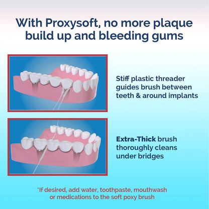 Proxysoft Dental Floss for Bridges & Implants – 6 Packs | Floss Threaders for Bridges, Implants & Braces