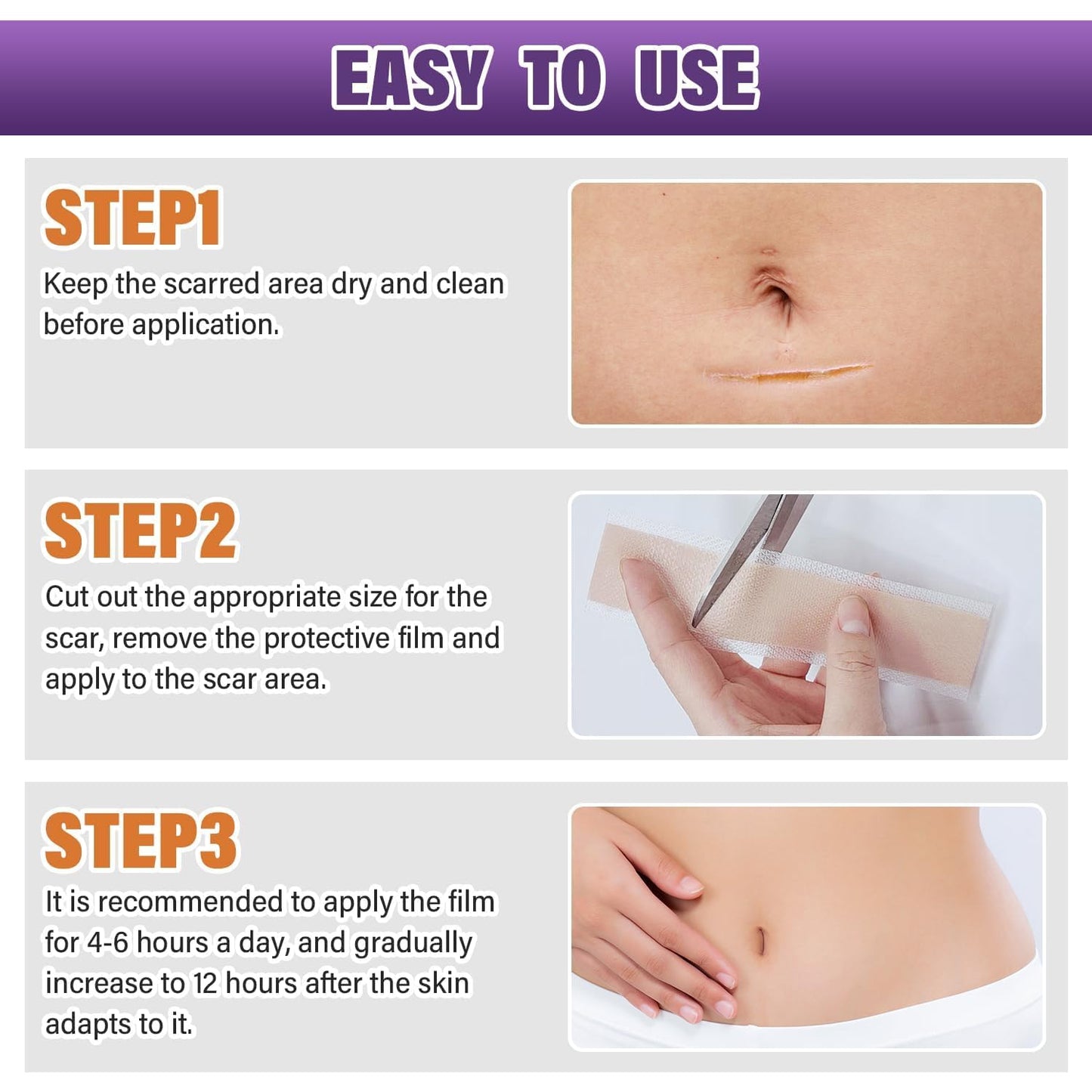 Psecici Silicone Scar Sheets & Tape – Medical-Grade, Reusable Scar Strips (1.6 x 59 in Roll)