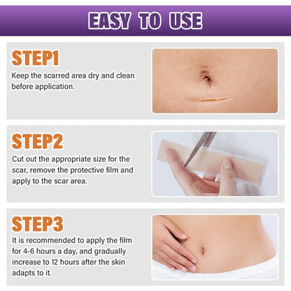 Psecici Silicone Scar Sheets Roll 1.6x120 – Medical-Grade Scar Tape for Surgical, C-Section, and Keloids