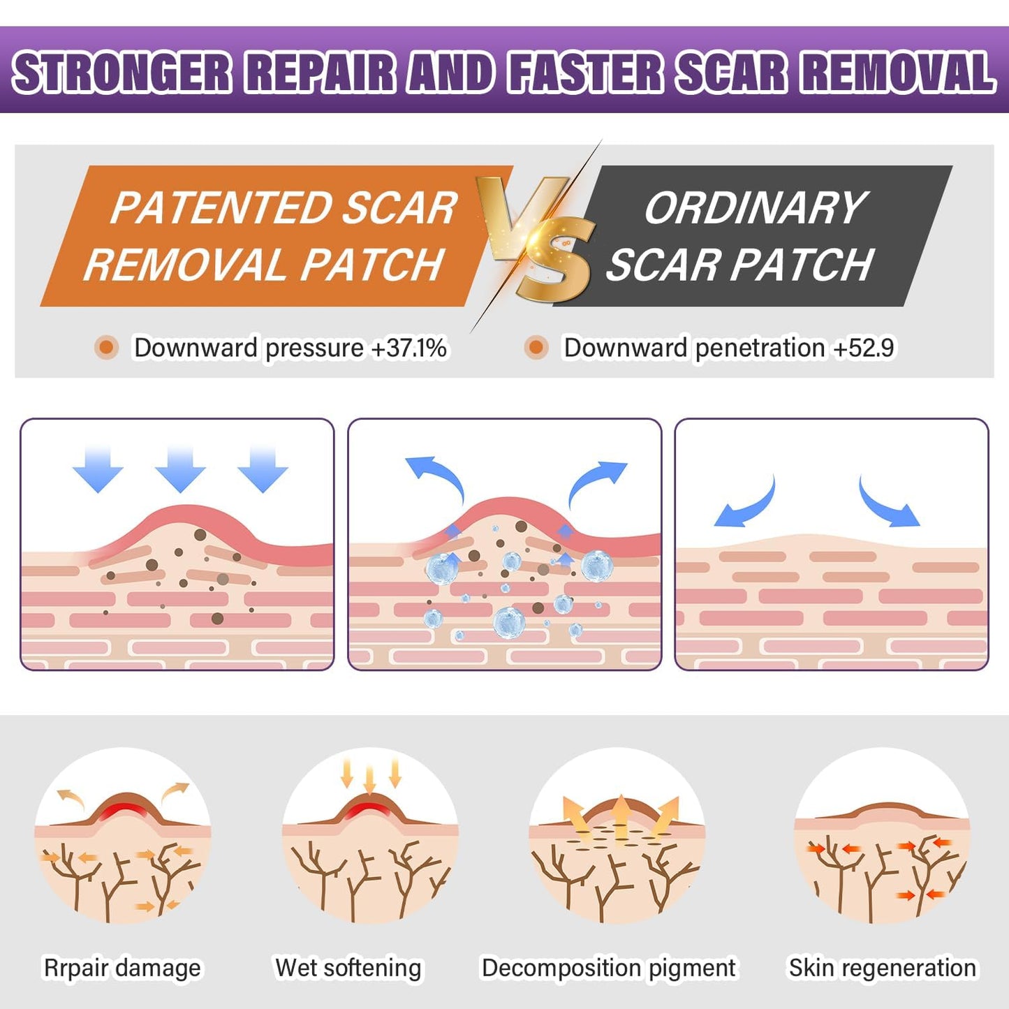 Psecici Silicone Scar Sheets Roll 1.6x120 – Medical-Grade Scar Tape for Surgical, C-Section, and Keloids
