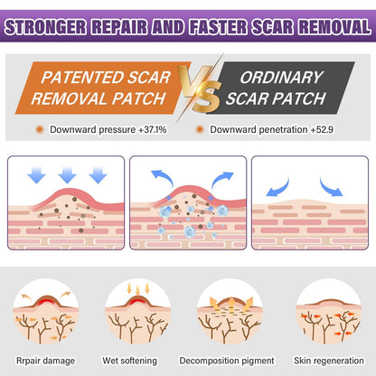 Psecici Silicone Scar Sheets & Tape – Medical-Grade, Reusable Scar Strips (1.6 x 59 in Roll)
