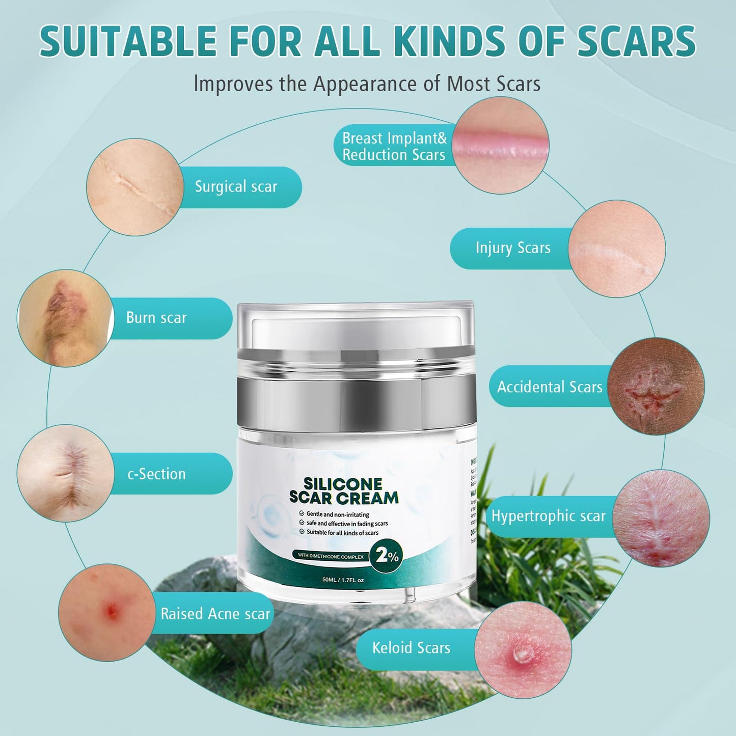 Pumkot Advanced Scar Cream — Silicone Gel for Surgical Scars & Stretch Marks (1.7 oz)