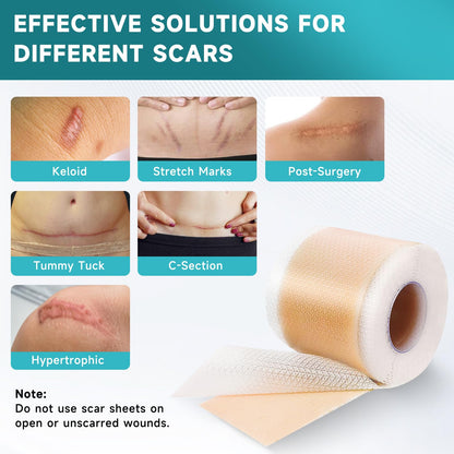 Pumkot Silicone Scar Sheets Roll 1.6in x 120in – Scar Tape for Surgical Scars