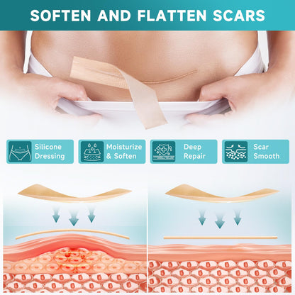 Pumkot Silicone Scar Sheets & Tape – 1.6”x60” Roll for Surgical Scars, C-Section & Burns