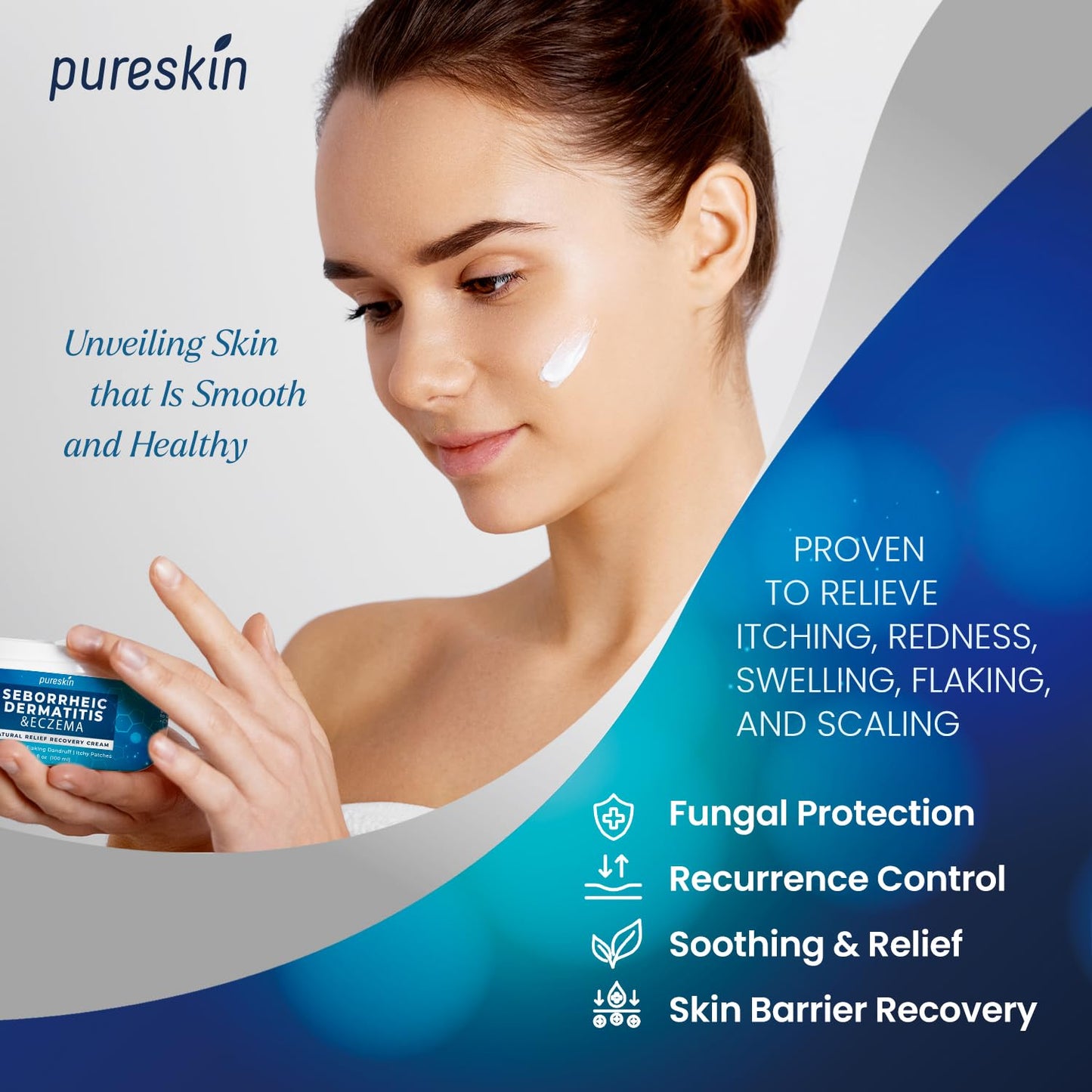 PureSkin Seborrheic Dermatitis & Psoriasis Cream – Steroid-Free Herbal Antifungal (3.4 oz)