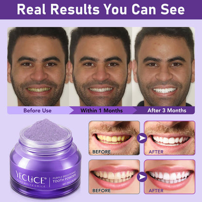 Purple Teeth Whitening Powder 30g - Removes Stains & Mint Fresh Breath